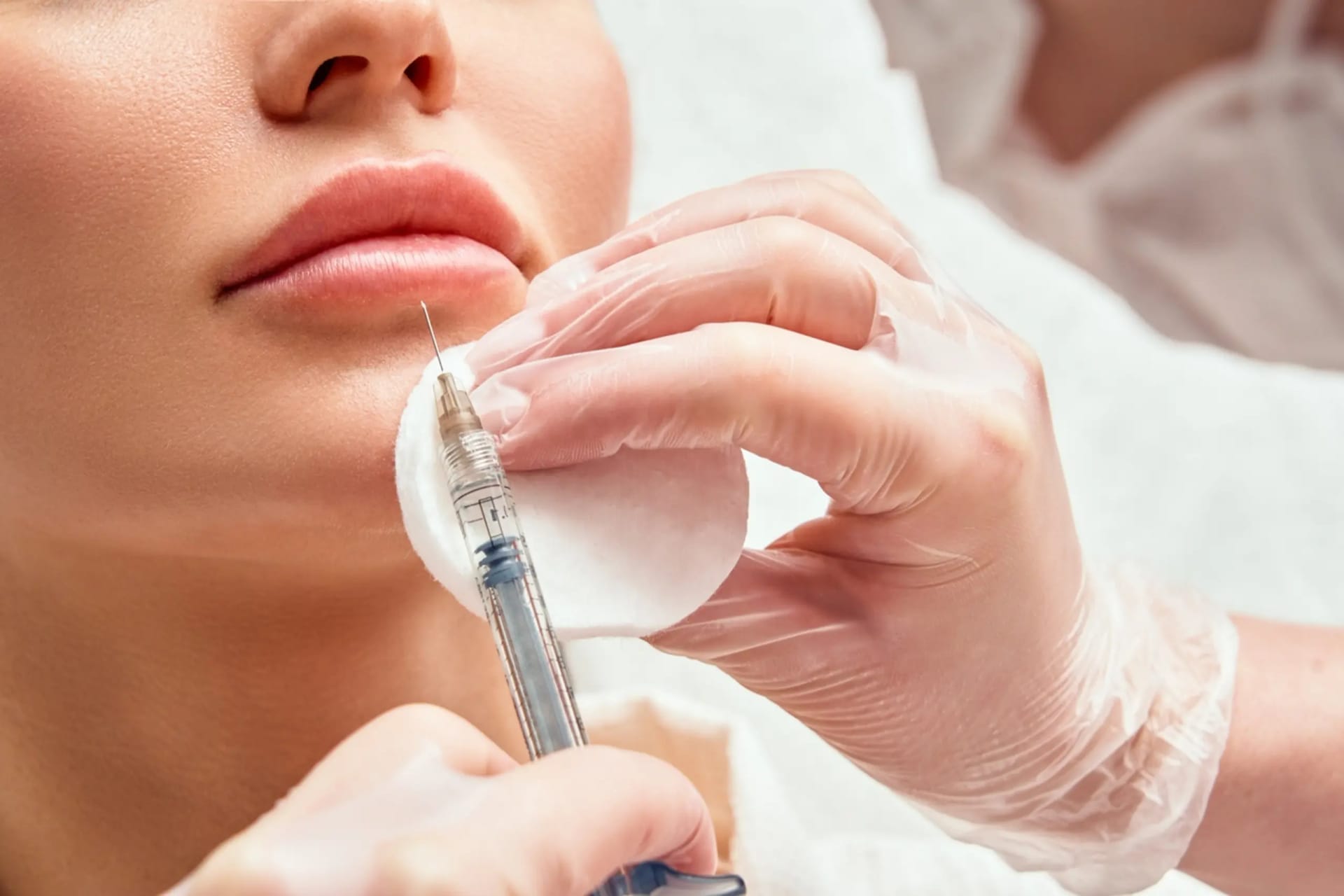 Optimieren Sie Ihr Aussehen mit Lippen Aufspritzen Nürnberg und Hautstraffung bei MY AESTHETICS