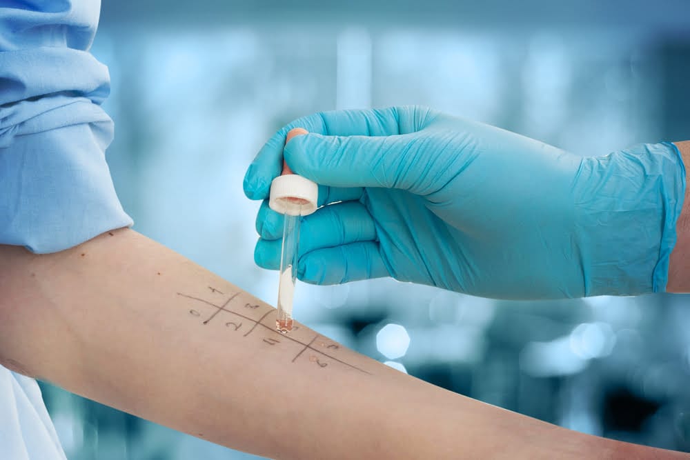 Allergietest Wien – Privat und Professionell in Ihrer HNO-Praxis