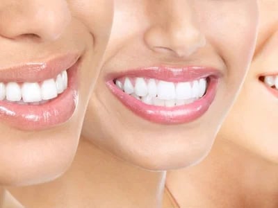 Von der ersten Beratung bis zur letzten Schiene: Die Invisalign Behandlung im Detail