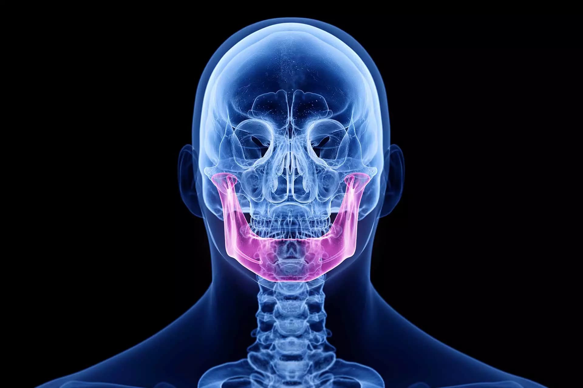 Craniomanibuläre Dysfunktion: Wie Sie den Zusammenhang zwischen Kiefergelenk und Schmerzen verstehen