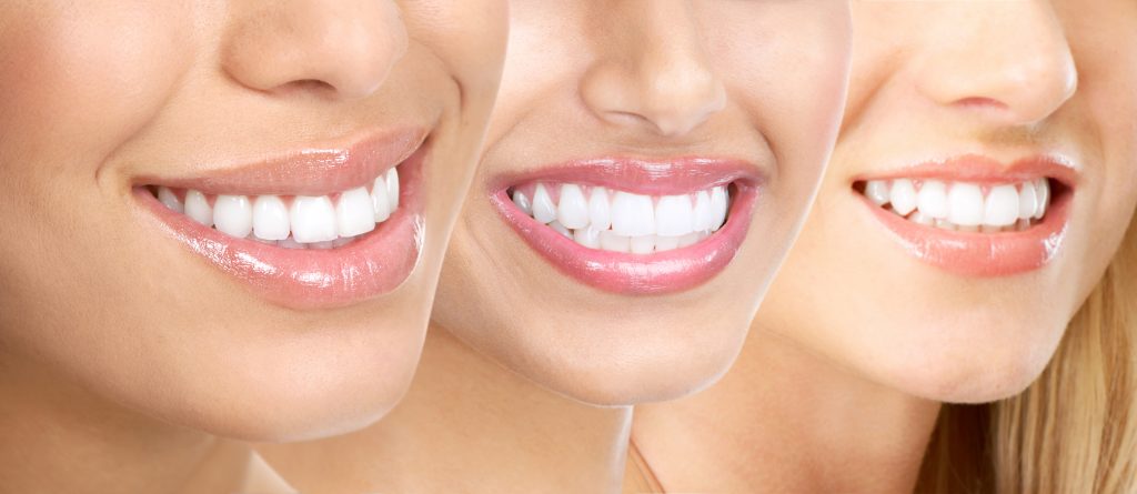 Von der ersten Beratung bis zur letzten Schiene: Die Invisalign Behandlung im Detail