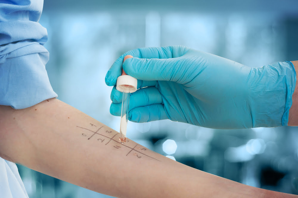Allergietest Wien – Privat und Professionell in Ihrer HNO-Praxis
