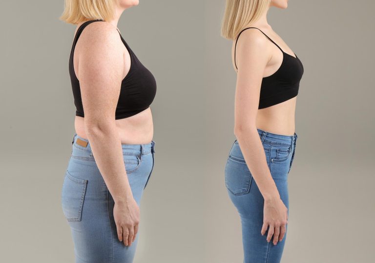 Weight-Loss-Concept-Before-and-After